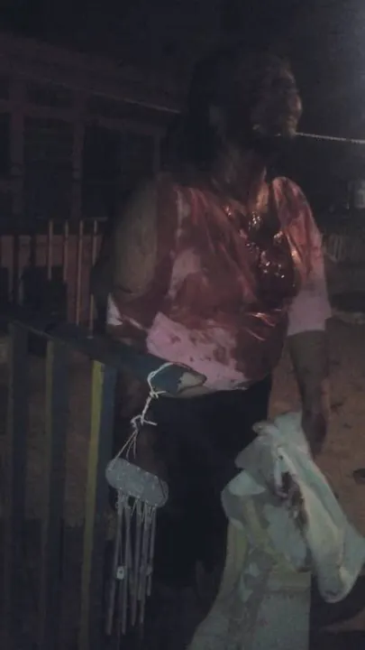 Reportan grave a mujer acuchillada en Izúcar;es hermana de uno de los 43 desaparecidos de Ayotzinapa