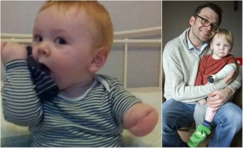De psicólogo a inventor: padre logra diseñar brazo para su bebé