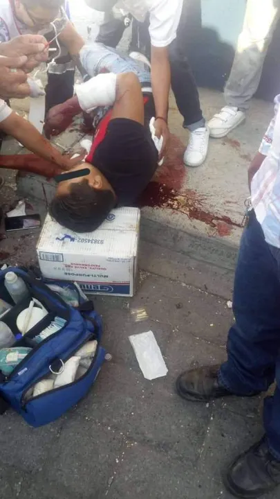 Fallece la pareja baleada en Huejotzingo