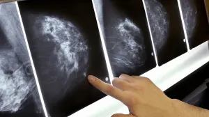 Cáncer y tumores, un tercio de cobertura de seguros