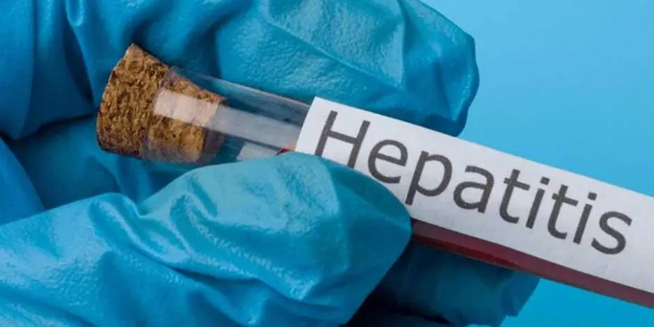 Nayarit reporta caso sospechoso de hepatitis aguda infantil