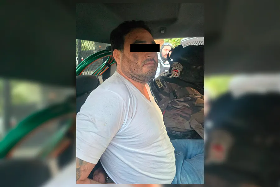 Cesar Alejandro N El Botox