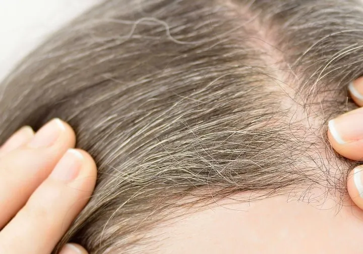 A todas nos choca encontrar una cana en el cabello, nos hace sentir que la vejez se está aproximando