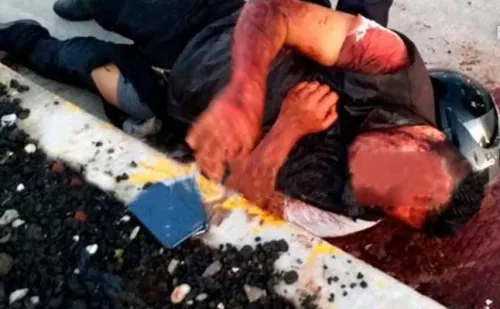Encuentran a hombre tirado y herido sobre la Vía Atlixcáyotl