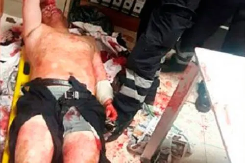 Alumno de la Universidad Politécnica de Tlaxcala apuñala a su profesor