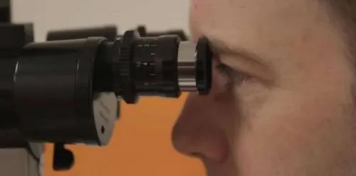 La inteligencia artificial de Google podría detectar enfermedades oculares