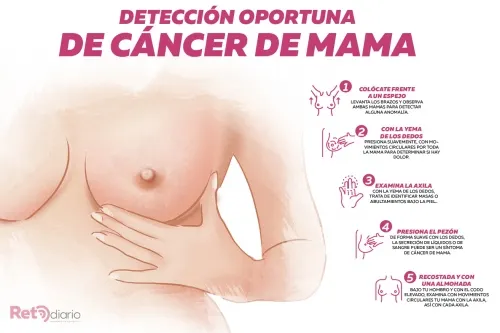 Autoexploración, clave para prevenir el cáncer de mama