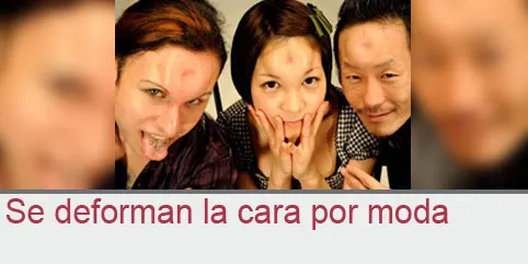 Se deforman la cara por moda
