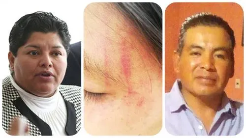 Karina Pérez protege a golpeador de mujeres