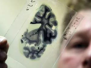 Cerebro humano, una poderosa herramienta
