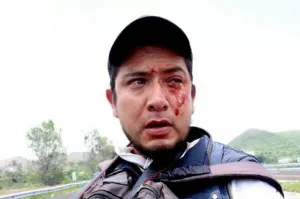 Lesionan a fotógrafo del Periódico Síntesis en zafarrancho de la Atlixcayotl