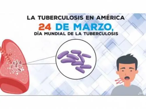 Tuberculosis, entre las principales causas de muerte a nivel mundial