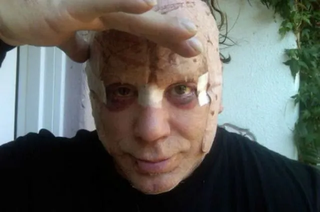 Mickey Rourke impacta con su rostro