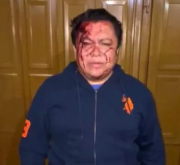 Comando armado golpea y amenaza de muerte a secretario general del Sindicato de Trabajadores del Ayuntamiento de Puebla