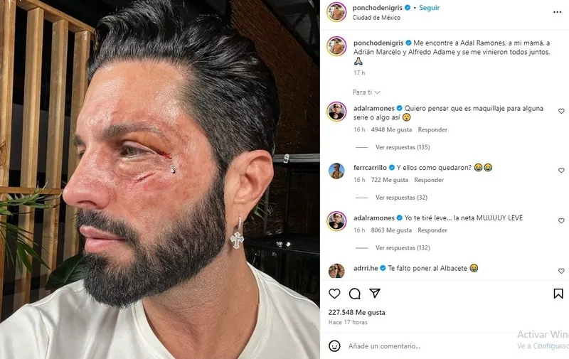 Adal Ramones le responde a Ponch de Nigris