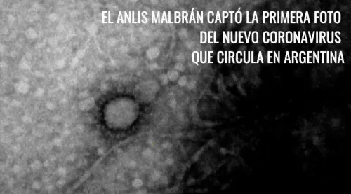Científicos de Argentina logran tomar la primera foto del coronavirus