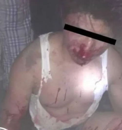 Golpean a presunto delincuente en la colonia Tlilostoc