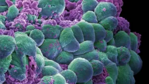 Cáncer, tercera causa de muerte en México