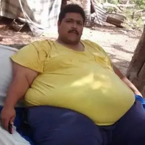 Murió Andrés Moreno Sepúlveda, ‘el hombre más obeso del mundo’