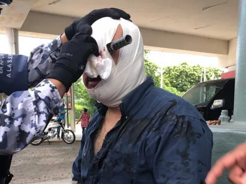VIDEO: Apuñalan a hombre en el ojo tras discusión por cajón de estacionamiento en Veracruz