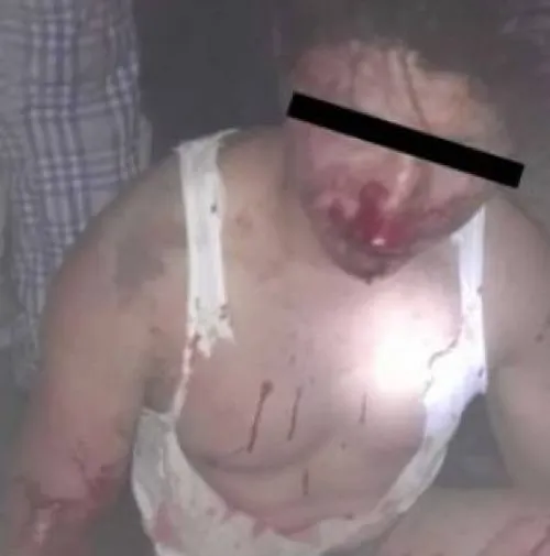 Golpean a presunto delincuente en la colonia Tlilostoc