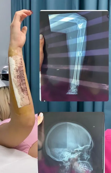 Gabriela, joven golpeada afuera del Karaoke la cantada