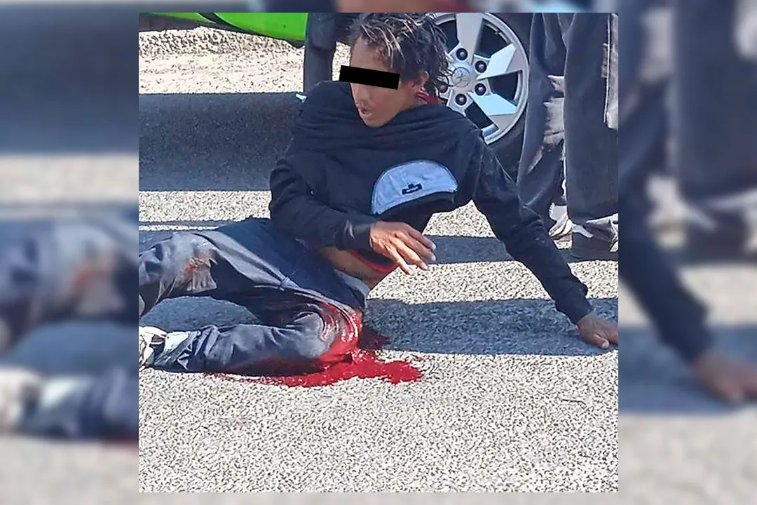 Presunto Ladron Golpeado San Jeronimo Caleras