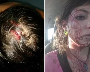 Previo a cometer asalto, ladrón dio golpiza a su pareja