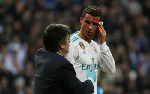 Cristiano termina con el rostro ensangrentado por una patada