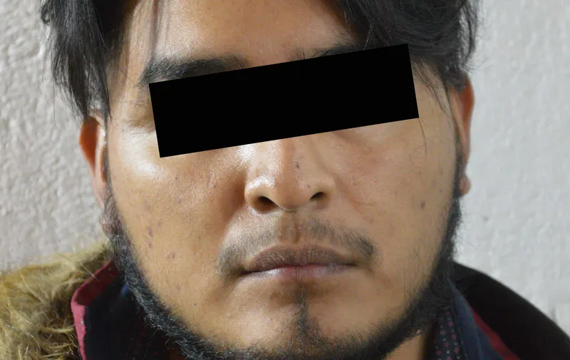 Imagen del artículo