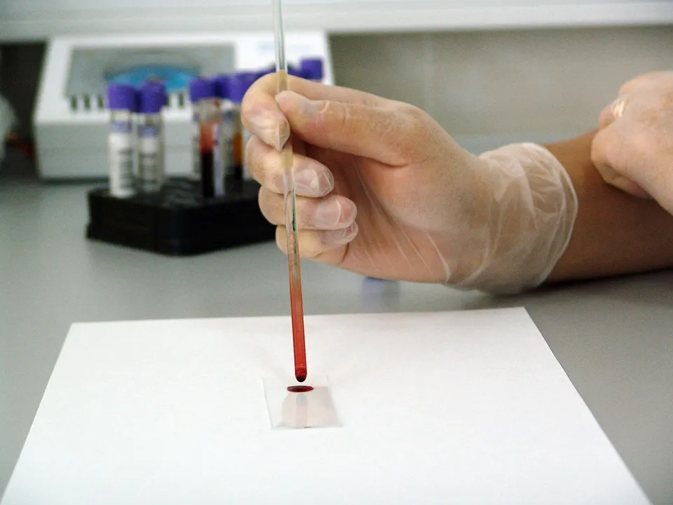 muestra de sangre