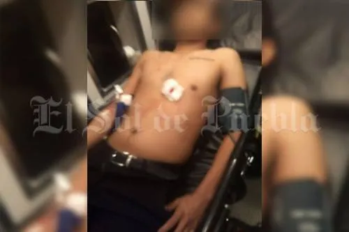 Hieren con arma blanca a joven en la Recta a Cholula