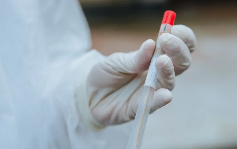 Nigeria confirma su primer caso de ébola en más de una década y rastrea 44 contactos