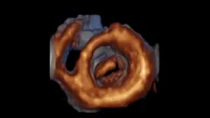 Captan en 4D imágenes de un corazón latiendo