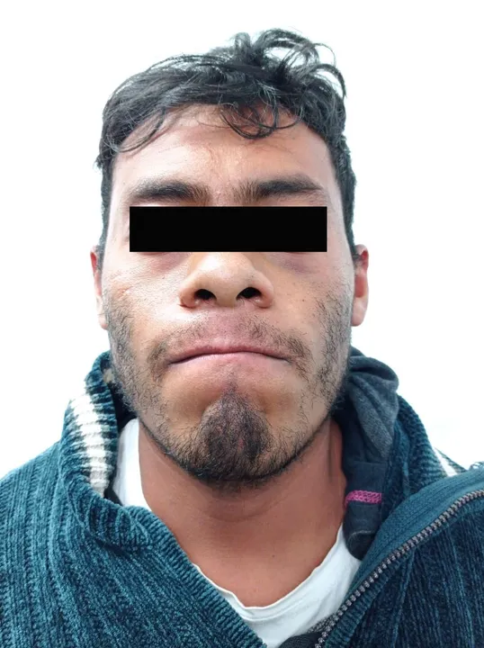 Detenido