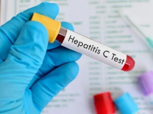 Puebla avanza en la erradicación de la hepatitis “C”: IMSS