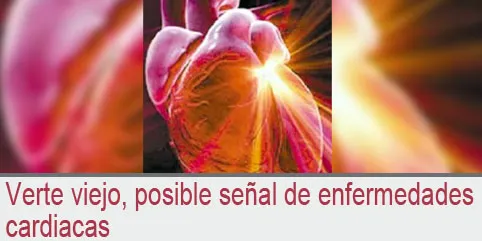 Verte viejo, posible señal de enfermedades cardiacas