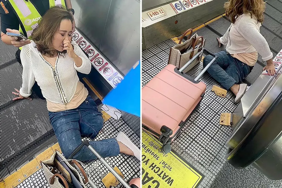 Mujer pierde la pierna en un aeropuerto