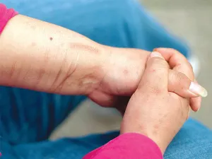 ‘Suicidio, tercera causa de muerte en jóvenes’; supera a los accidentes de tránsito, afirman