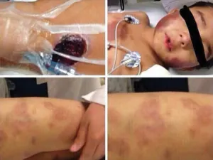 Reportan delicado a menor golpeado en Edomex; ministeriales investigan agresión