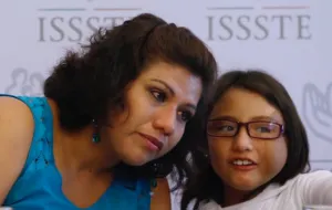 Reconstruyen rostro a niña de seis años en el Issste