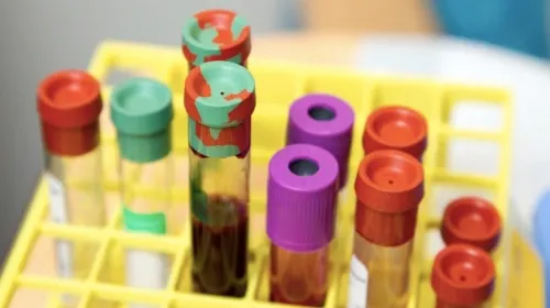 Facebook y Secretaría de Salud lanzan herramienta para facilitar donaciones de sangre