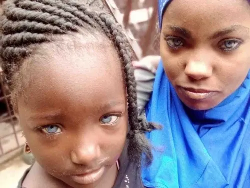 Abandonó a su esposa e hijas por tener ‘extraños’ ojos azules, así lucen