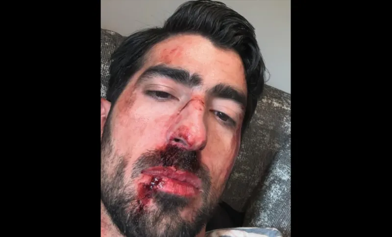 Jezzini preocupa a seguidores al aparecer con el rostro ensangrentado