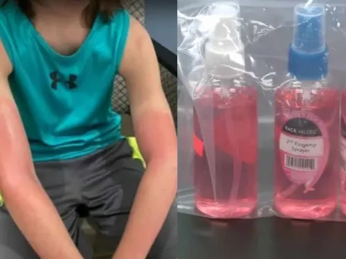 Vende gel antibacterial adulterado y niño termina en el hospital