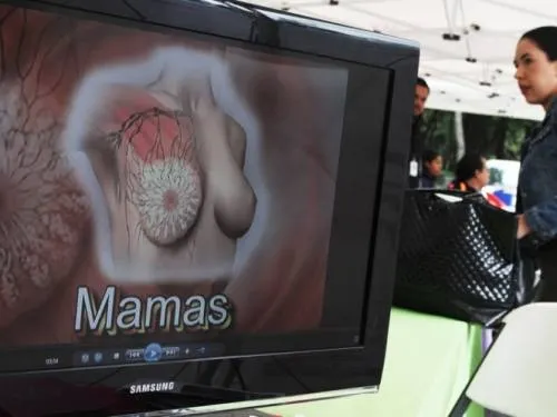 Sube 22% la mortalidad por cáncer de mama
