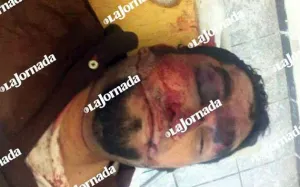 Peritos de PGR y Semar hicieron identificación del supuesto cuerpo de “El Chayo”