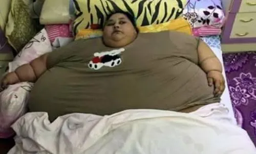 La mujer más obesa del mundo muere mientras recibía tratamiento
