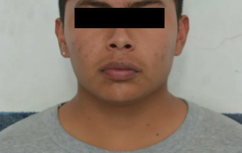 Imagen del artículo