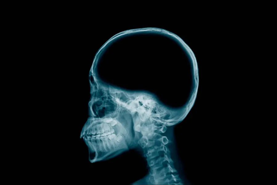 Foto Sin.cerebro